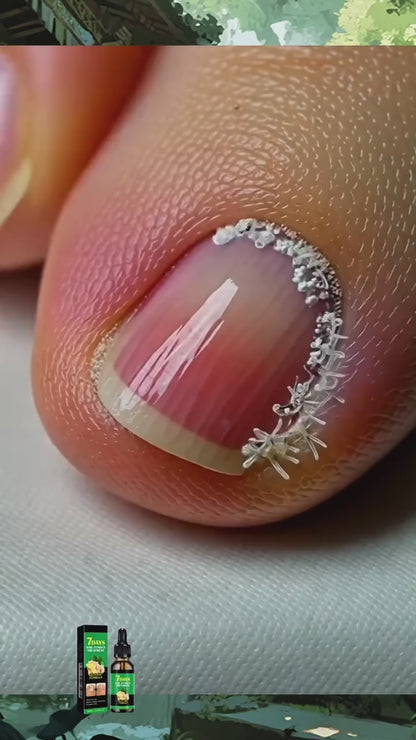 Serum 7 Days para el Hongo en las Uñas - LUCE UNAS UÑAS SANAS Y HERMOSAS